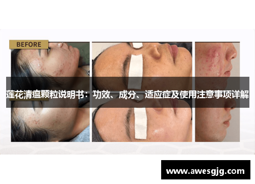 莲花清瘟颗粒说明书：功效、成分、适应症及使用注意事项详解